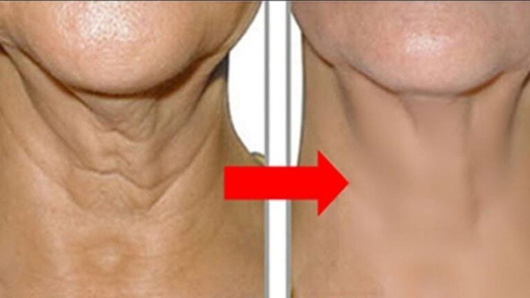 This surprising trick removes neck wrinkles instantly for a younger, radiant appearance…
