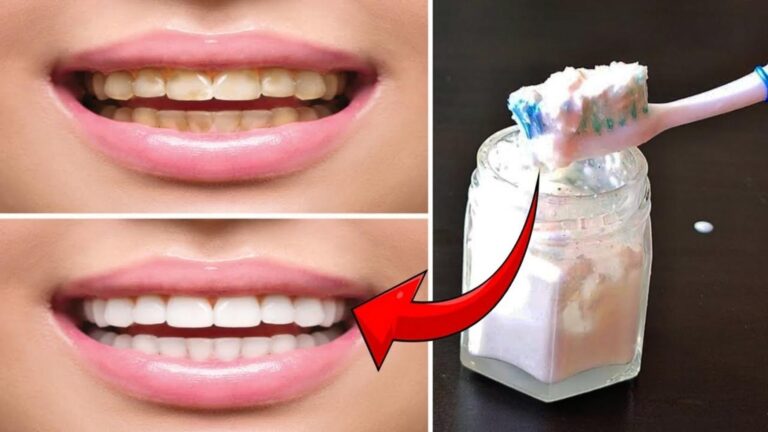 This simple trick transforms yellow teeth into a glowing smile… you’ll love the results!
