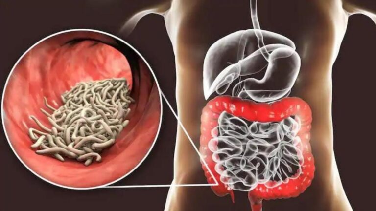 This forgotten trick transforms your health by naturally fighting parasites in your body…