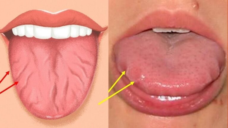 This simple remedy transforms dry lips into a kissable paradise…