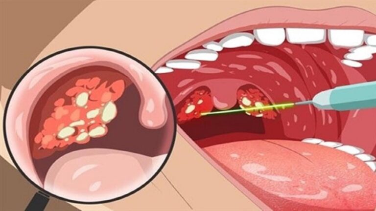 This simple gesture can reveal a surprising health issue you shouldn’t ignore…