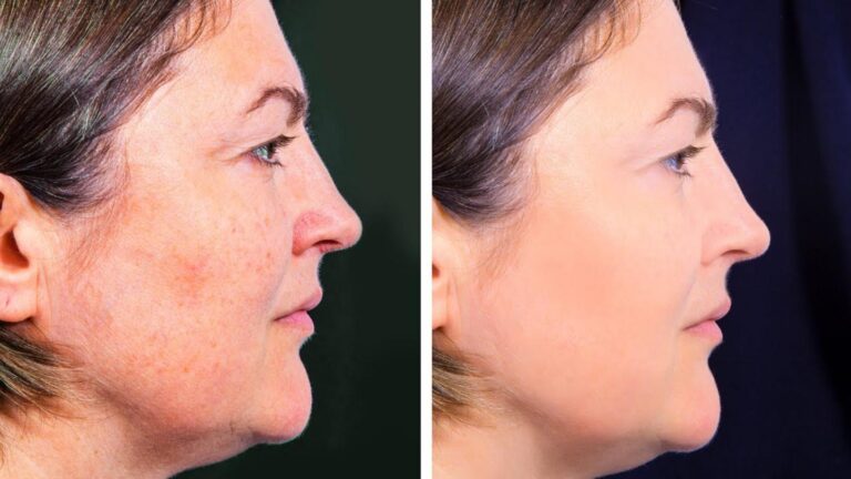 This simple remedy can reveal youthful skin and fade blemishes overnight…