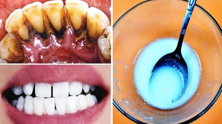 This simple method transforms yellowed teeth into a dazzling smile in just 2 minutes…