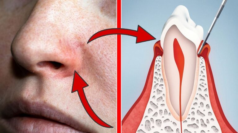 7 Signs of Vitamin A Deficiency You Should Never Ignore! Discover the Facts Now!