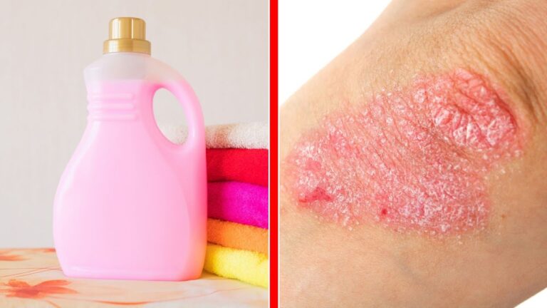 5 Surprising Reasons Fabric Softener Can Harm Your Skin You Need to Know!