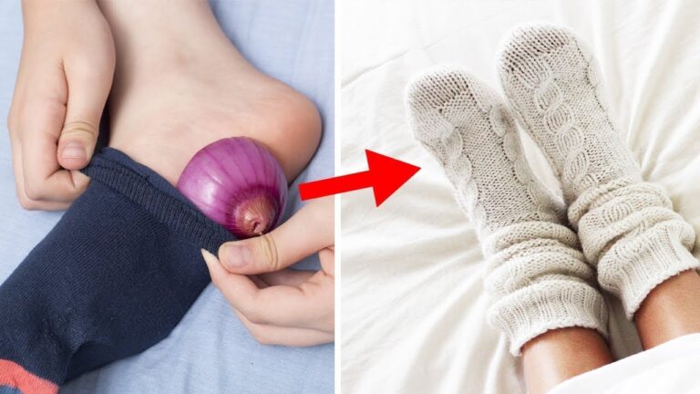 Sleep with an Onion in Your Sock: 5 Surprising Benefits Revealed!