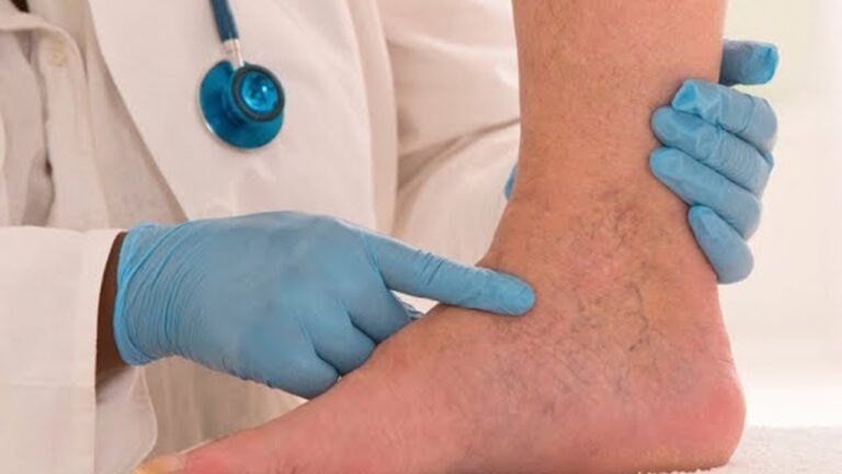 7 Effective Tips to Improve Blood Circulation Naturally!