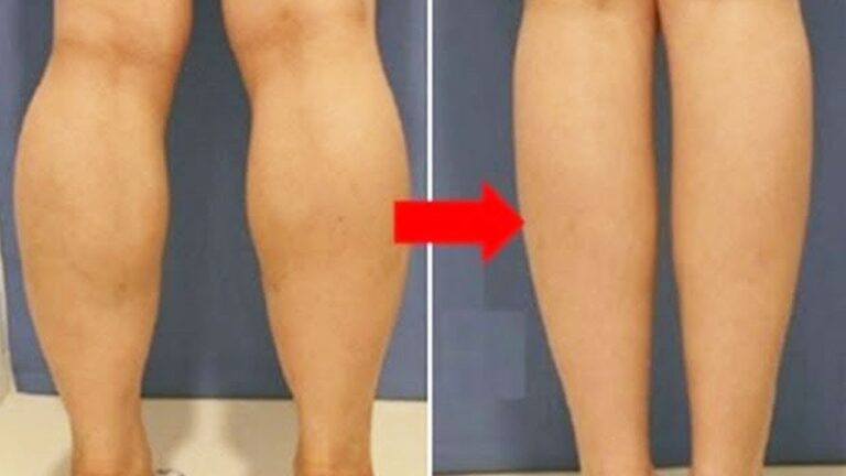 Achieve Beautiful Calves in Just 4 Weeks with These Simple Tips!