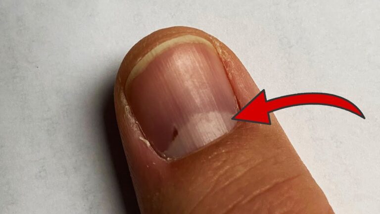 Discover 5 Secrets Behind the Half Moon on Your Nail – You’ll Be Surprised!